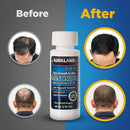 Minoxidil Liquid Extra Strength Hair Regrowth Treatment for Men, Women