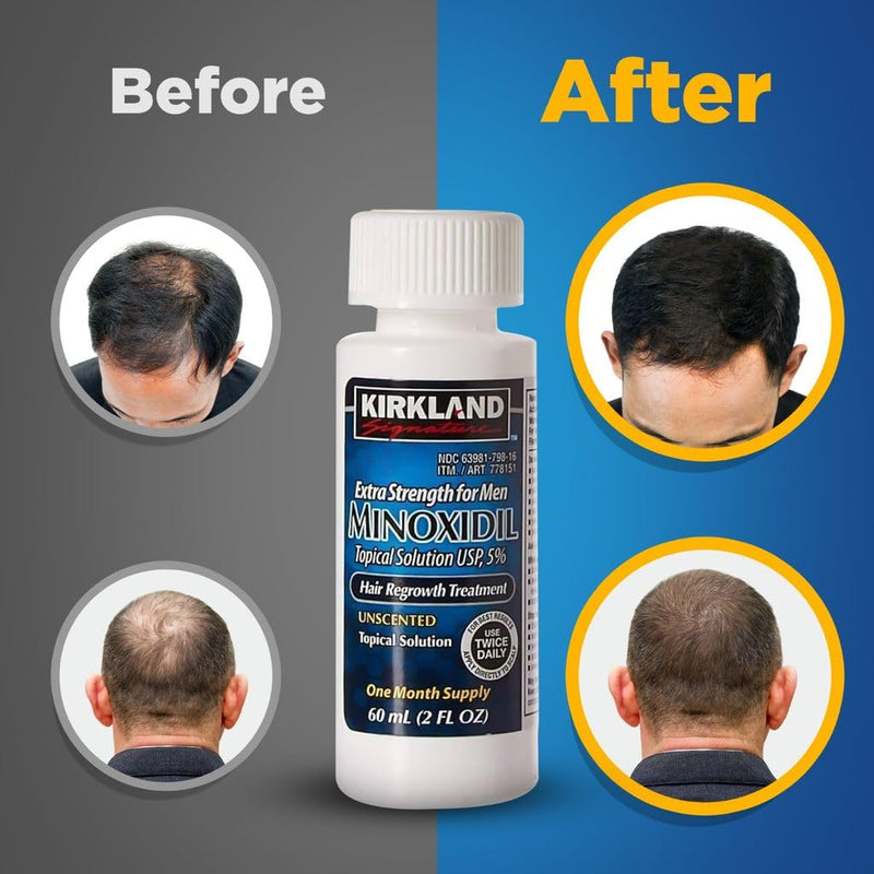 Minoxidil Liquid Extra Strength Hair Regrowth Treatment for Men, Women