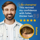 Minoxidil Liquid Extra Strength Hair Regrowth Treatment for Men, Women