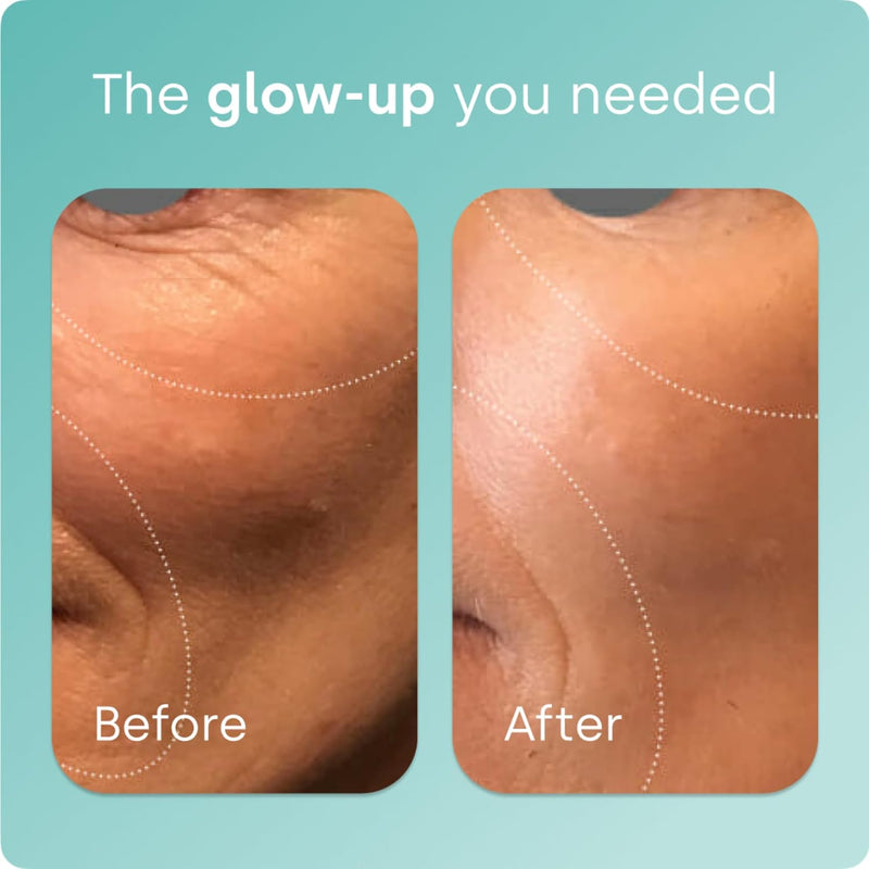 Biosil Collagen Generator with ch,OSA help Your Body’s Beauty 120 Capsules