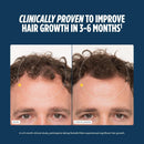 Nutrafol Men’s Hair Growth Supplement – Clinically Tested for Thicker Hair, Dermatologist Recommended, 1-Month Supply