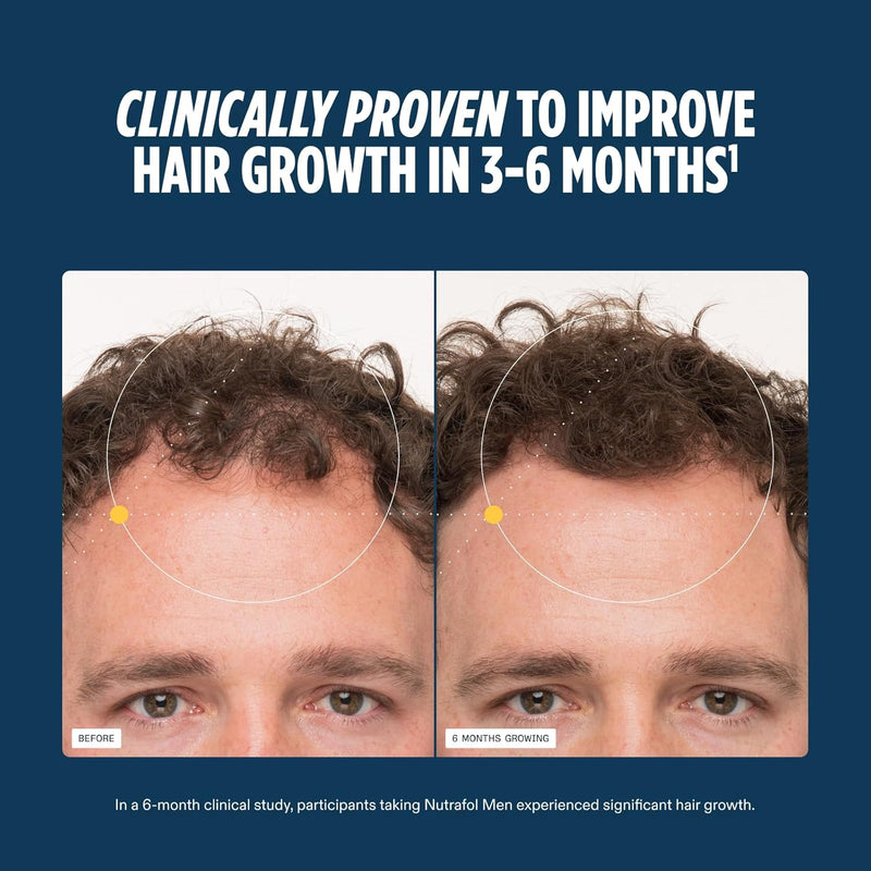 Nutrafol Men’s Hair Growth Supplement – Clinically Tested for Thicker Hair, Dermatologist Recommended, 1-Month Supply