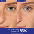 Caudalie Vinoperfect Brightening Dark Spot Serum Vitamin C Alternative - 62x More Effective than Vitamin C with Viniferine for a Visibly Brighter Even Complexion