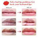 Cherry Vitamin Lip Masks