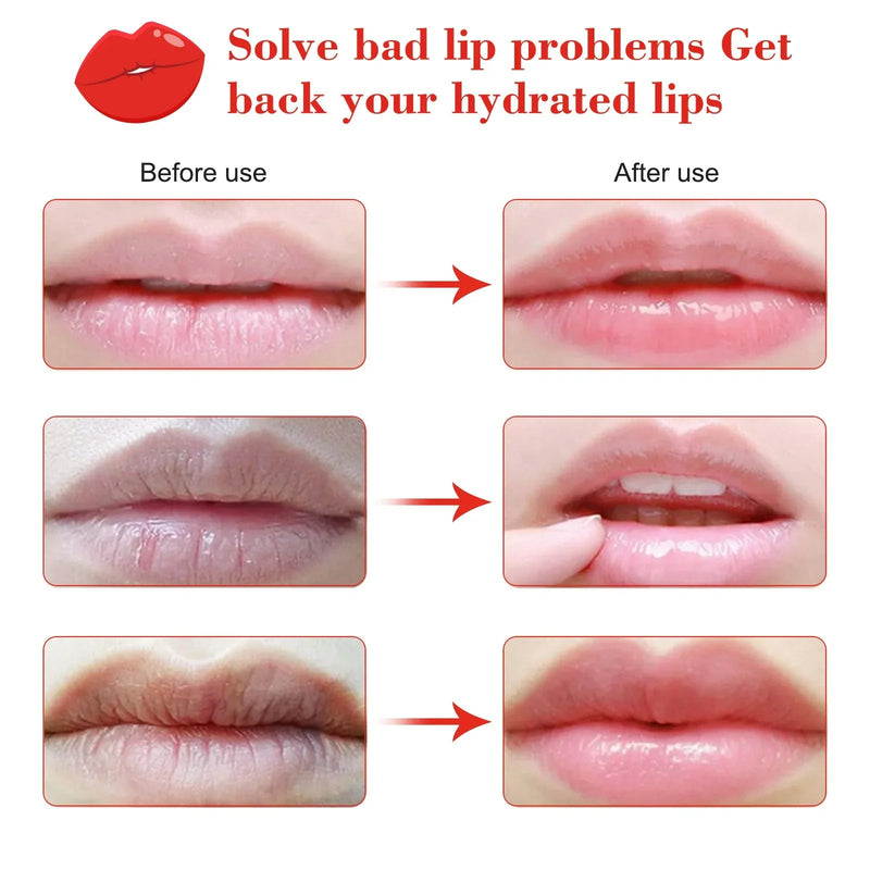 Cherry Vitamin Lip Masks