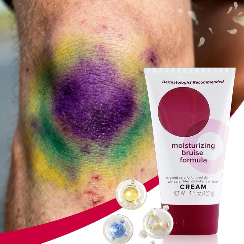 Dermend Moisturizing Bruise Formula 4.5 Oz Cream- Arms, Legs & Body Relief Cream