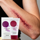 Dermend Moisturizing Bruise Formula 4.5 Oz Cream- Arms, Legs & Body Relief Cream